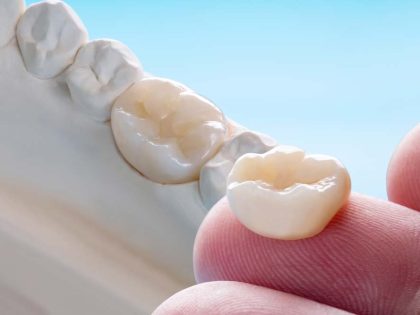 Prótesis dental fija o removible: Cómo escoger la adecuada