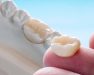 dedo-sujeta-protesis-dentales-fijas-removibles