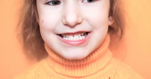 niña sonriendo con mordida cruzada