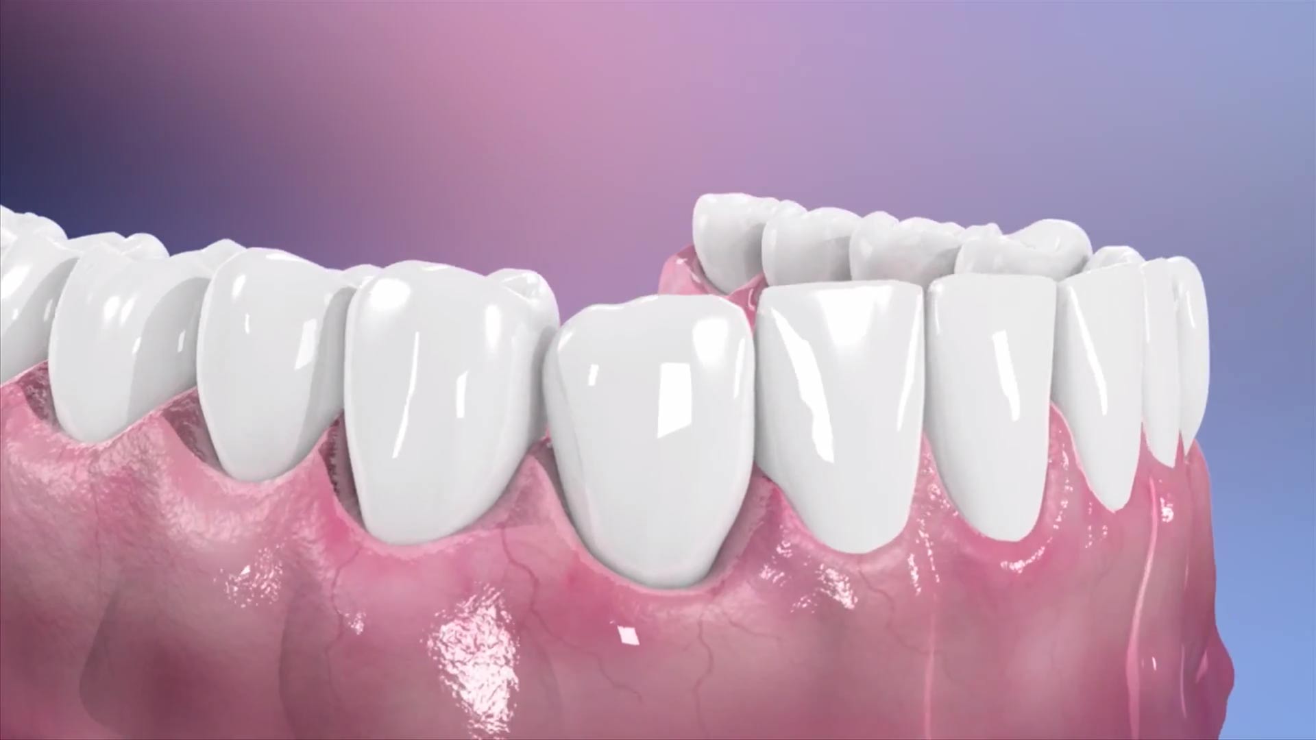 Irritación de la encía, Periodoncia