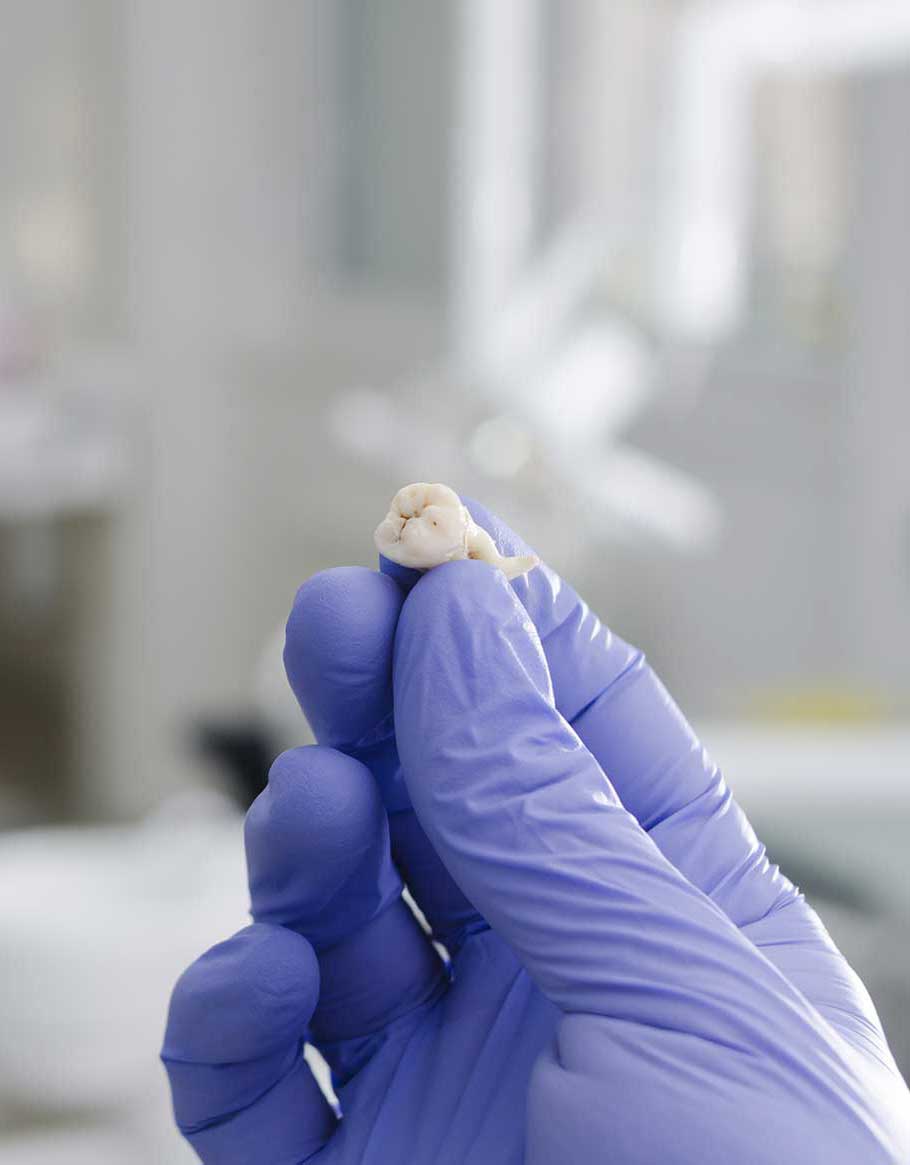 Salud dental - Extracciones