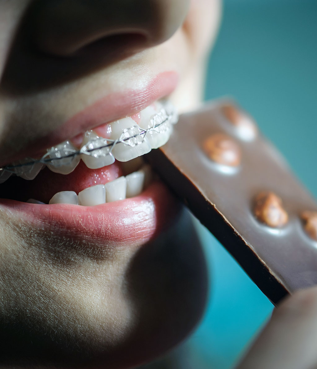 Brackets Estéticos en Palma de Mallorca Clínica Dental Fàbregues