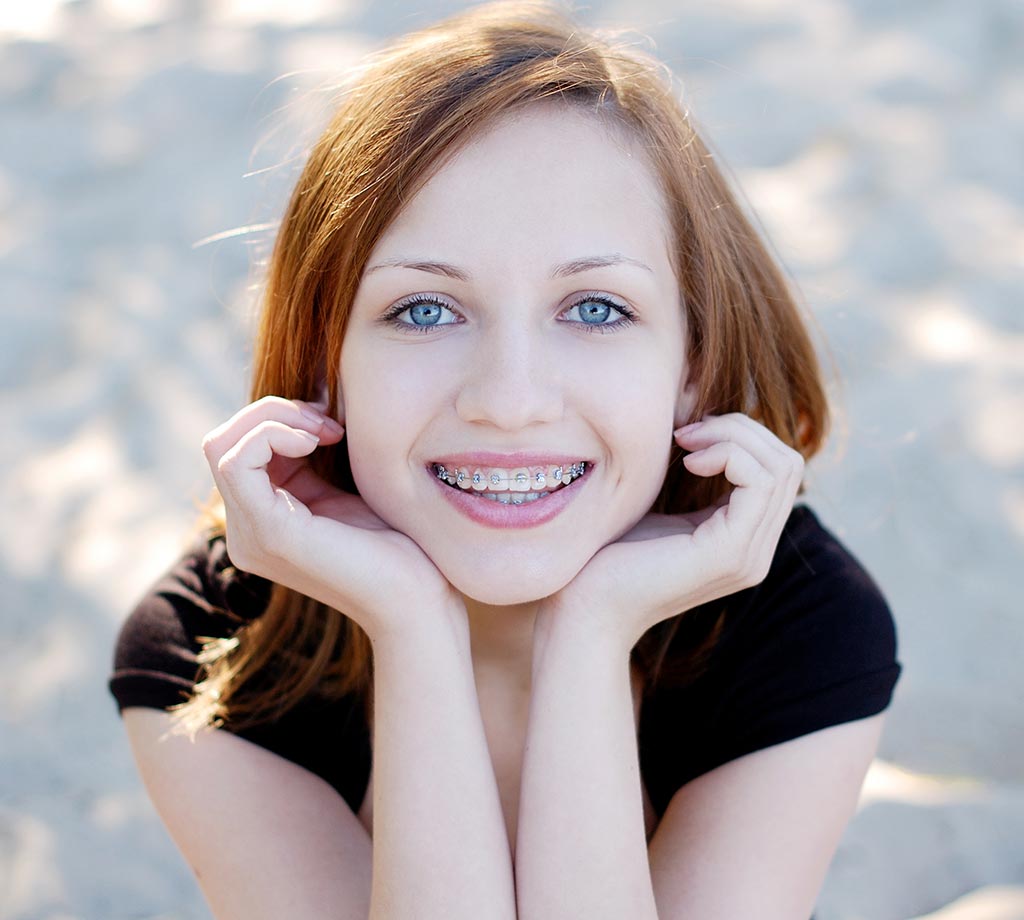 mujer sonriendo con brackets metálicos